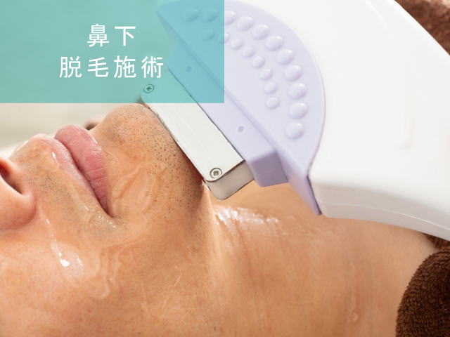 鼻下ヒゲ脱毛Step4