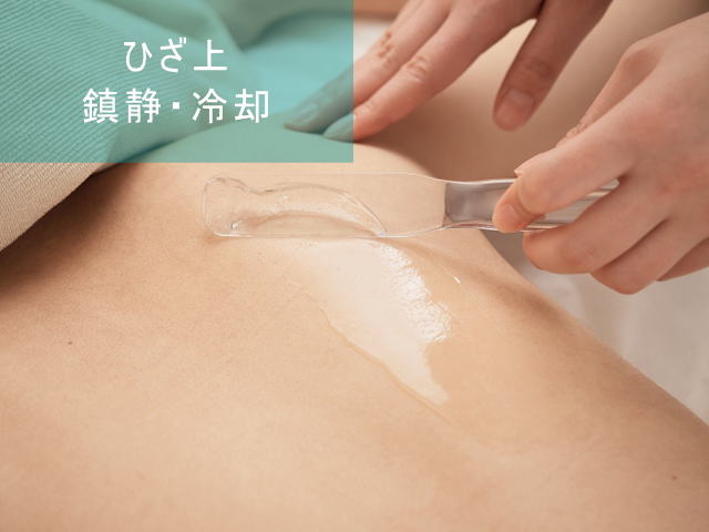 ひざ上脱毛Step5