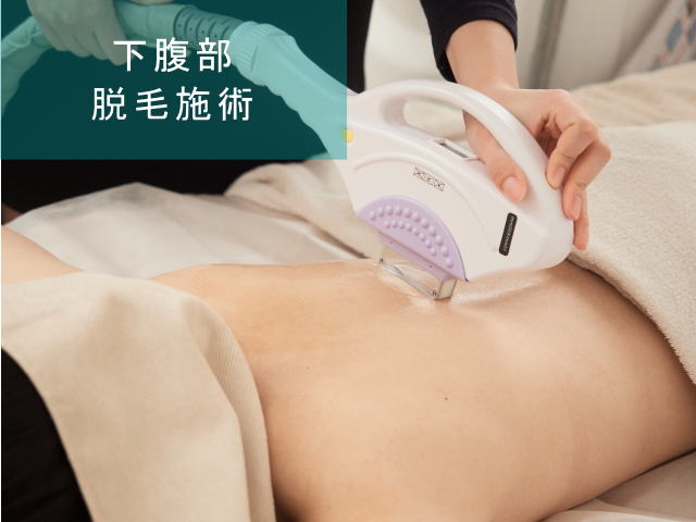 下腹部脱毛Step4