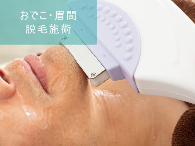 おでこ・眉間脱毛Step4