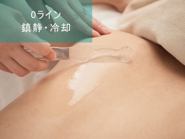 Oライン脱毛Step5